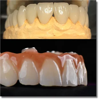 UT ekstremalių 9820mm geriausią estetinį poveikį, cirkonio dantų blokai dantų lab