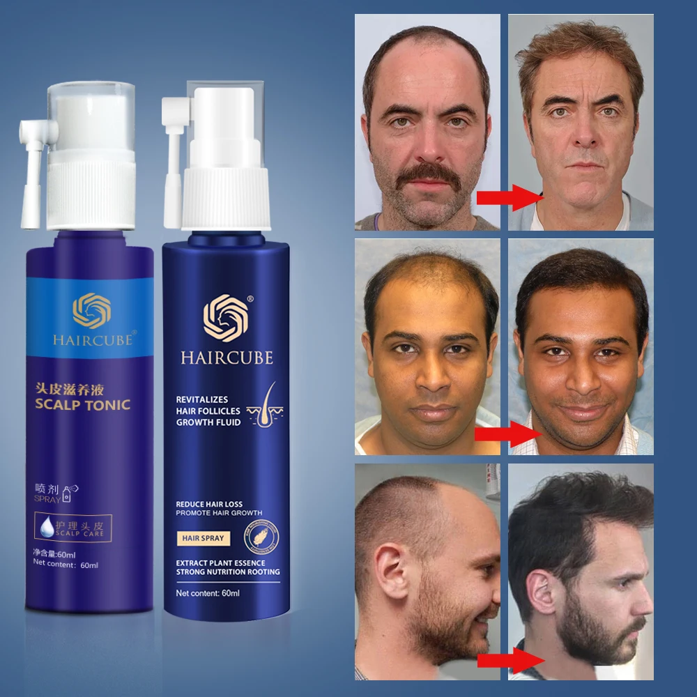 HAIRCUBE Plaukų Augimo Esmė Germinaciniai Greitai Plaukų Augimo Serumas Esmė Aliejus, Plaukų Slinkimas Gydymo Augimo Plaukų Vyrams, Moterims