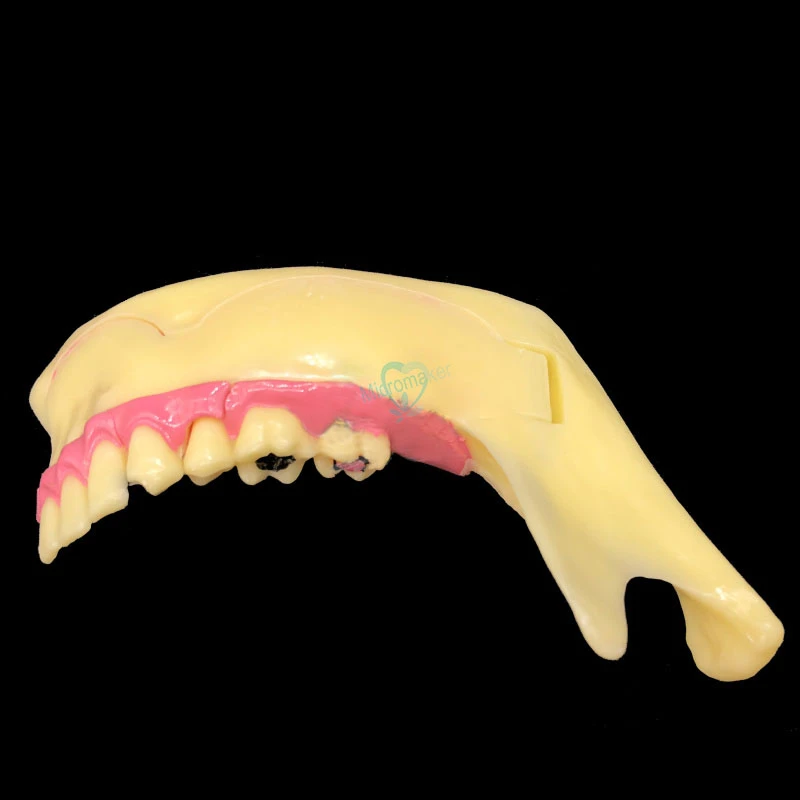 1pcs Dantų keičia apatinio žandikaulio Dantų Demonstravimas Paciento Anatomijos Studijų Mokymo Modelį