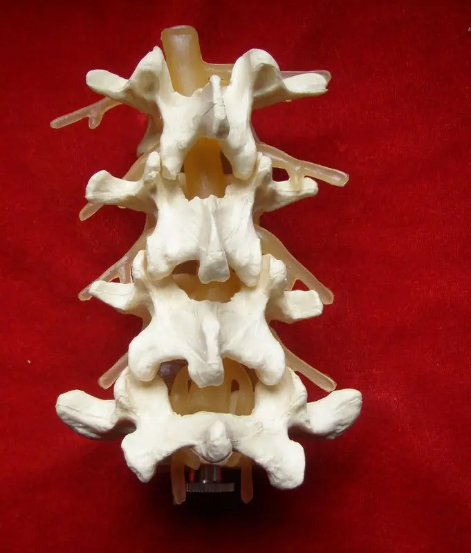 Žmogaus Skeleto Modelis Juosmens Disko Ligos Modelis Stuburo Modelis Juosmens Kaulų Pakitimai Modelis Medicinos Mokslų Mokymo Išteklių