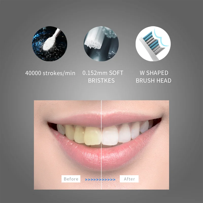 Elektrinis Įkraunamas dantų Šepetėlis Suaugusiems su Laikmačiu Rūpintis Jūsų Dantys, Kaip Stomatologas USB Įkrovimą, Dantų Balinimas su 4 Režimai 551