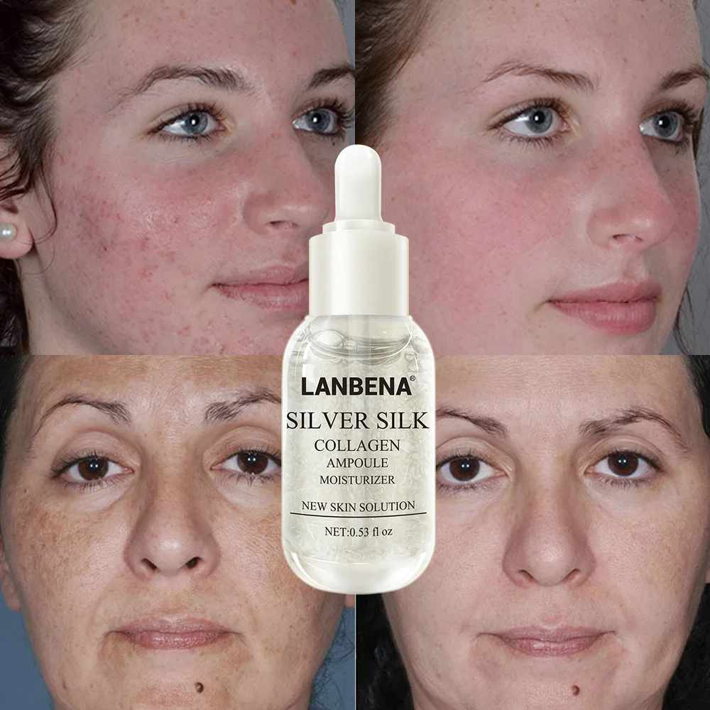 LANBENA serumas veidui Sidabro, šilko baltymų butelis esmė sraigė skystis, sugriežtinti poras, drėkina veido serumas odos priežiūros 15ml